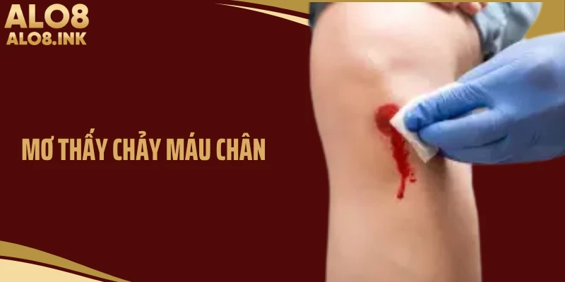 Mơ Thấy Chảy Máu Chân- Giải Mã Ý Nghĩa Và Con Số Chuẩn